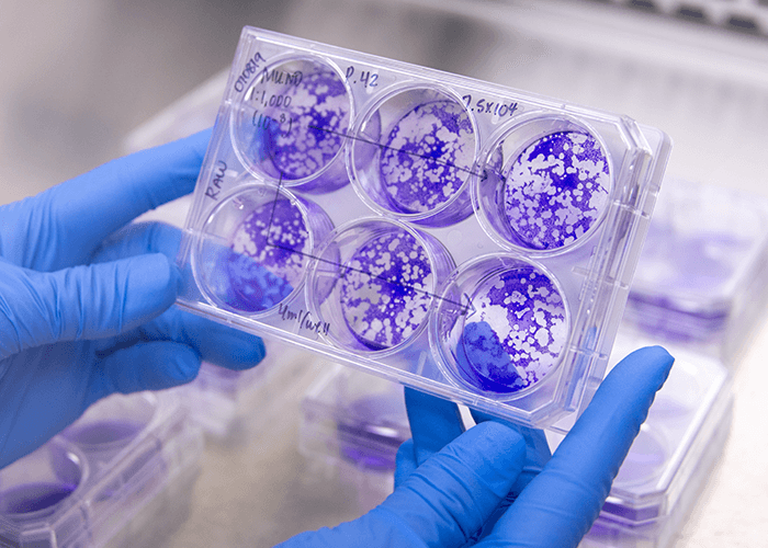 A lab technician examines blooms of cyanobacteria from water samples